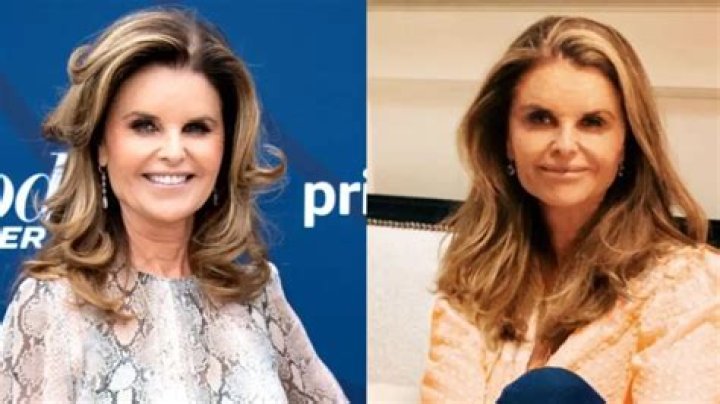 Maria Shriver’s Plastic Surgery No Longer Recognizable While Spotted