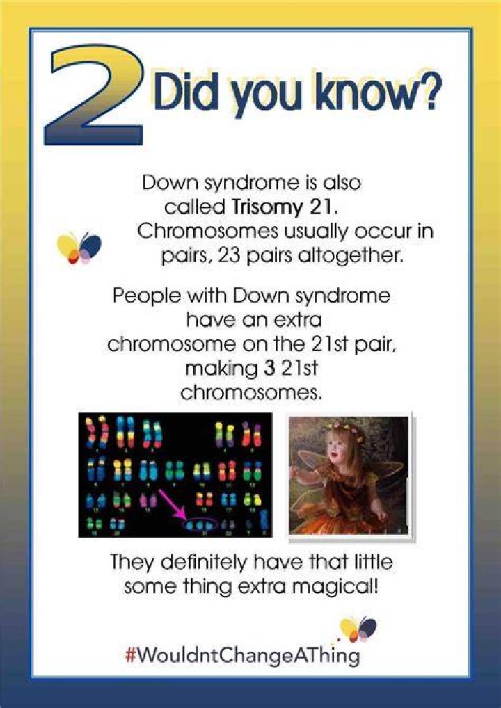 Things to Know About Down Syndrome Physical Traits Carrie with Children