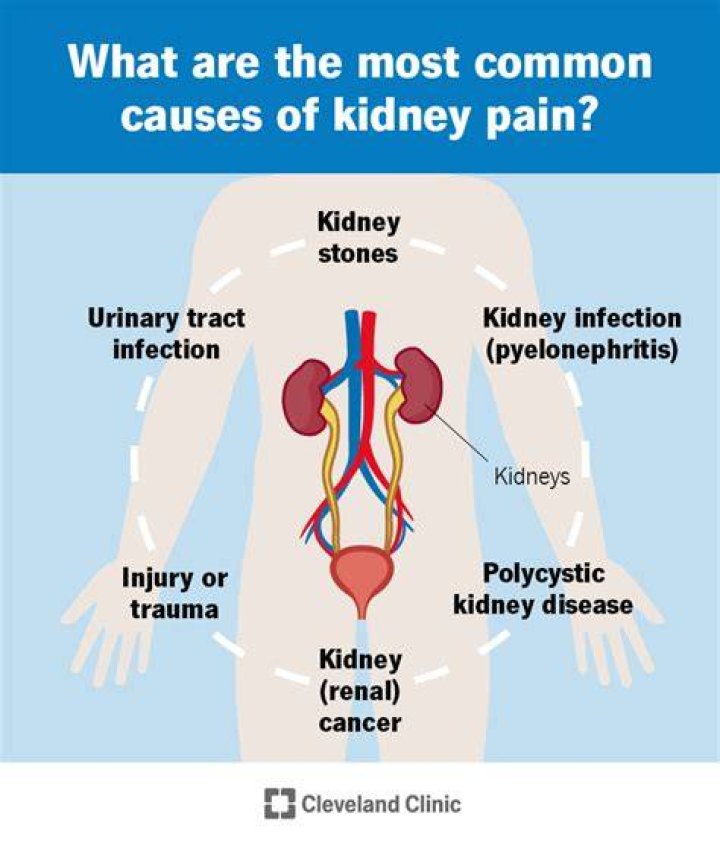 Why Do My Kidneys Hurt So Much